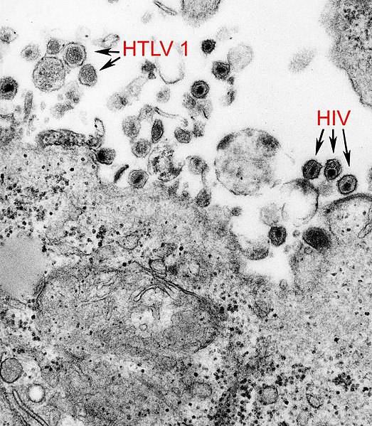 Investigadores desarrollan test de HTLV, un virus subdiagnosticado de la familia del HIV