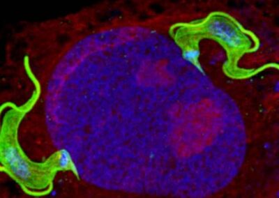 Foto tomada por investigadores del IP Montevideo será la tapa de la revista Parasitology