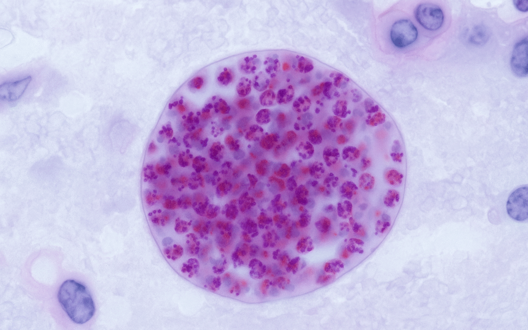 A Toxoplasmosis Parasite Could Affect Male Fertility