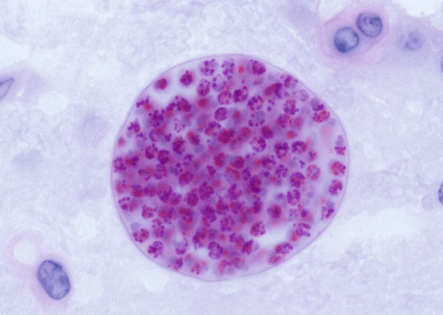 A Toxoplasmosis Parasite Could Affect Male Fertility
