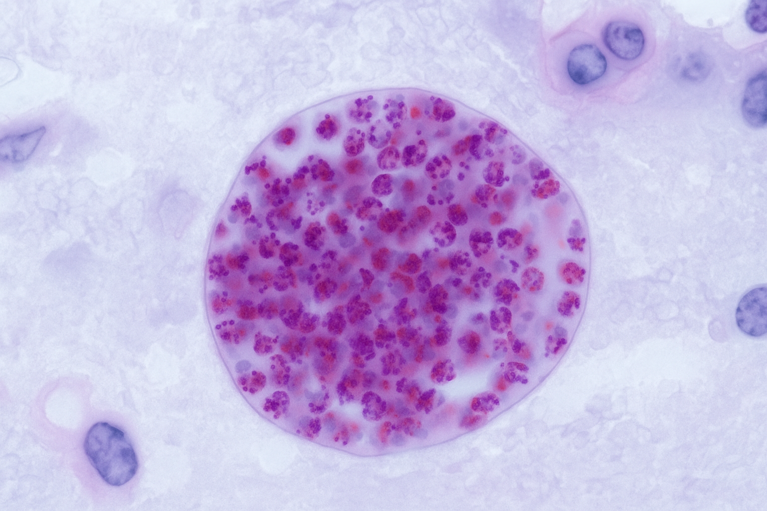 Toxoplasma Gondii