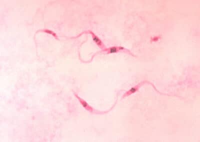 Mapa completo del genoma del parásito del Chagas cambia lo que se sabía sobre su biología